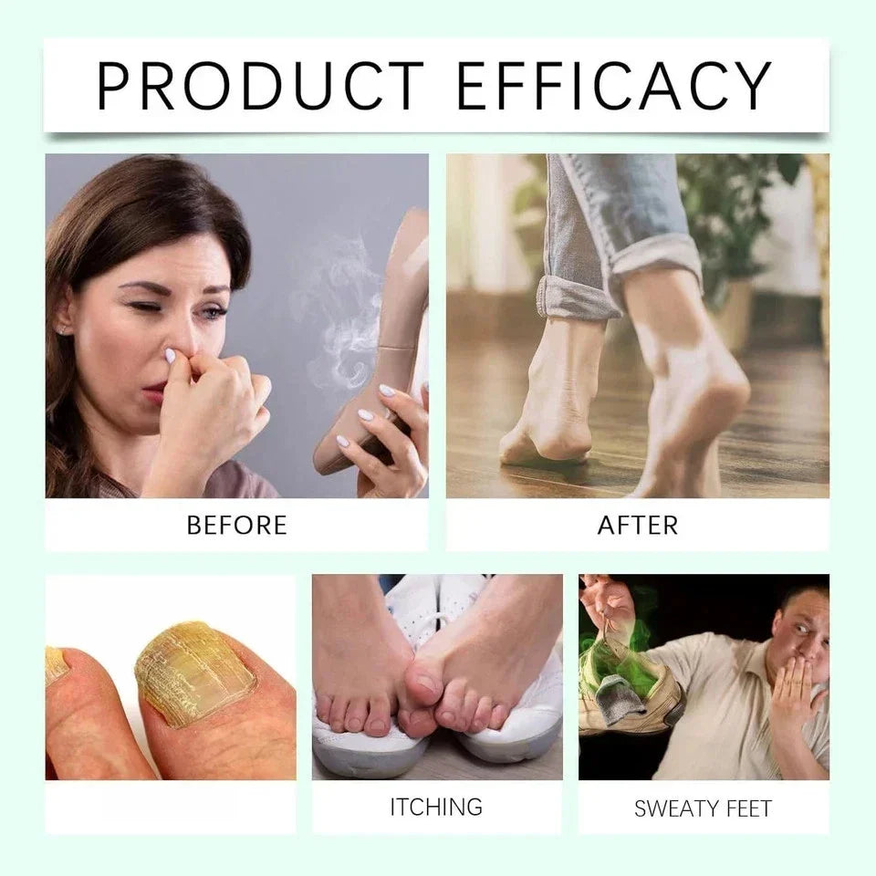 2pcs Ximonth Foot Sanitizer Spray with Tea Tree Oil, Tea Tree Oil Feet Spray